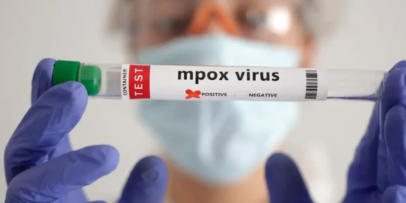 A test tube labelled