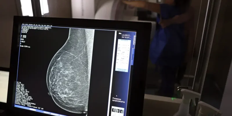Brasília (DF), 01/10/2024 - Teste de mamografia realizado na Campanha Outubro Rosa: Sesc-DF, que oferece exames e consultas gratuitas às mulheres.  Foto: José Cruz/Agência Brasil