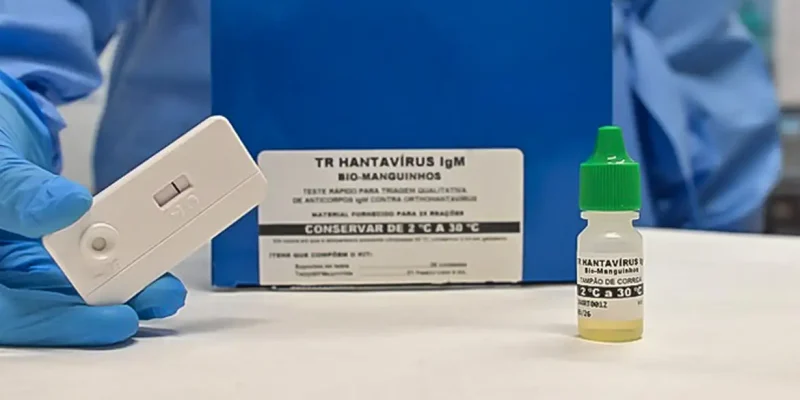 Teste rápido para hantavirose: TR Hantavírus IgM Bio-Manguinhos, com destaque para suporte de teste, apresentando resultado negativo, e frasco com solução reagente. Foto: Rudson Amorim, IOC/Fiocruz