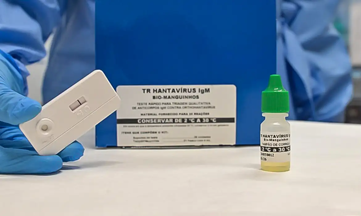 Teste rápido para hantavirose: TR Hantavírus IgM Bio-Manguinhos, com destaque para suporte de teste, apresentando resultado negativo, e frasco com solução reagente. Foto: Rudson Amorim, IOC/Fiocruz