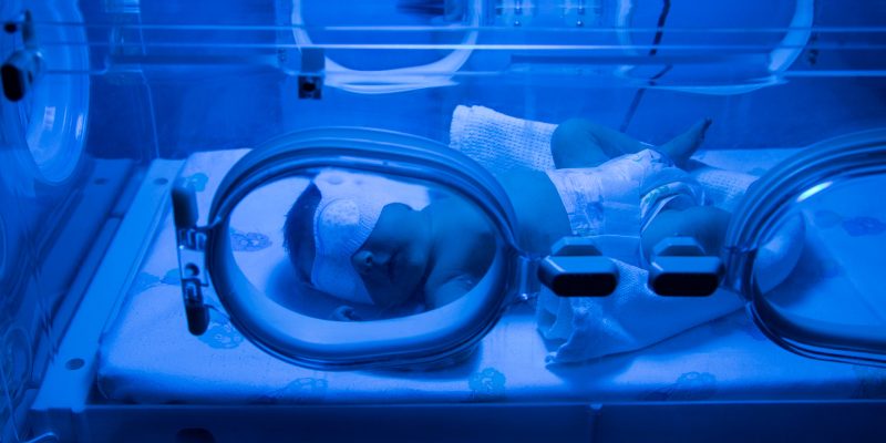 bebê recém-nascido, vestindo apenas fralda e uma máscara de proteção nos olhos, deita-se dentro de uma incubadora neonatal sob uma forte luz azul de fototerapia
