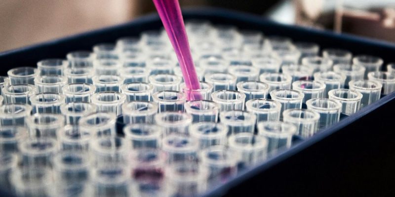 Laboratório médico, medicina. Foto: Louis Reed/Unsplash