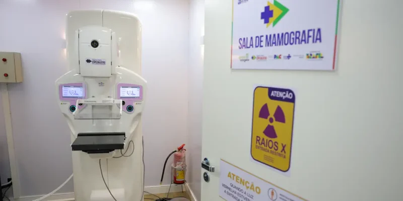 Brasília (DF) 23/10/2025 - Equipamento de mamografia da carreta de saúde da mulher do programa Agora Tem Especialistas no estacionamento do Hospital Regional de Ceilândia, cidade satélite de Brasília Foto: Fabio Rodrigues-Pozzebom/ Agência Brasil